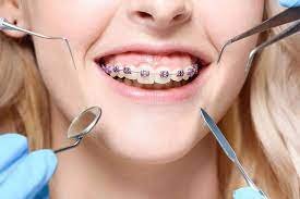 orthodontist in Hialeah